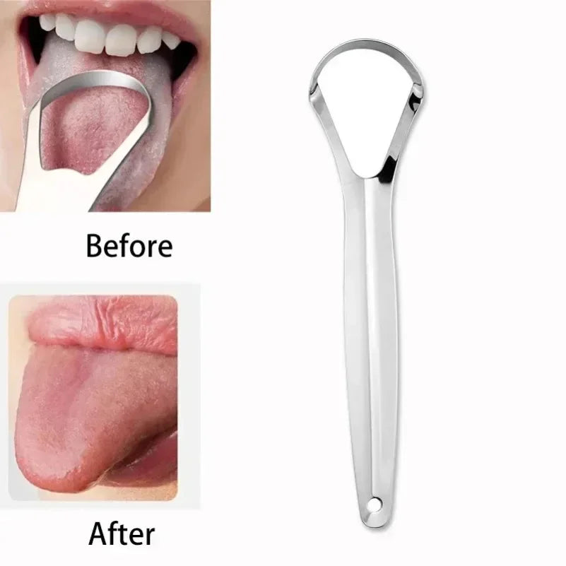 Tongue scraper